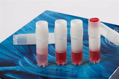 Acylated Ghrelin ELISA Kits 